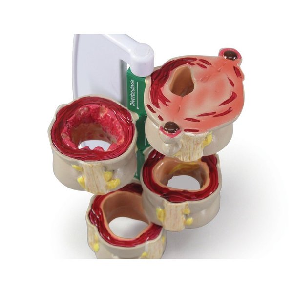 Gpi Anatomical Anatomical Model - 4-Piece Colon 3341